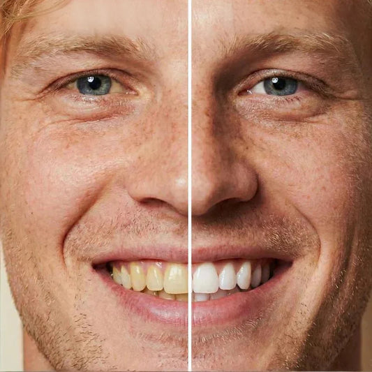 🔥1 vásárol 1 ingyen kap🦷5 Másodpercben Fehérebb Mosoly! Instant Whitening Tooth Paint – Biztonságos + Tartós!