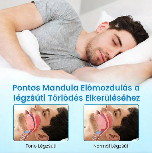 🎁Vásárolj 1 kapsz 1 ingyen😴Horkolásgátló szájbetét – Csökkentse a horkolást már az első éjszakától! 🛏️CPAP/MAD Alternatíva – 180 Napos Garancia!