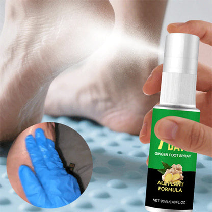🔥🔥2+1 ingyenes💨 Lábféreg eltávolító spray🦶 Gyömbéres lábhámlasztó spray – Fájdalommentes, gyors hatású puhaság!