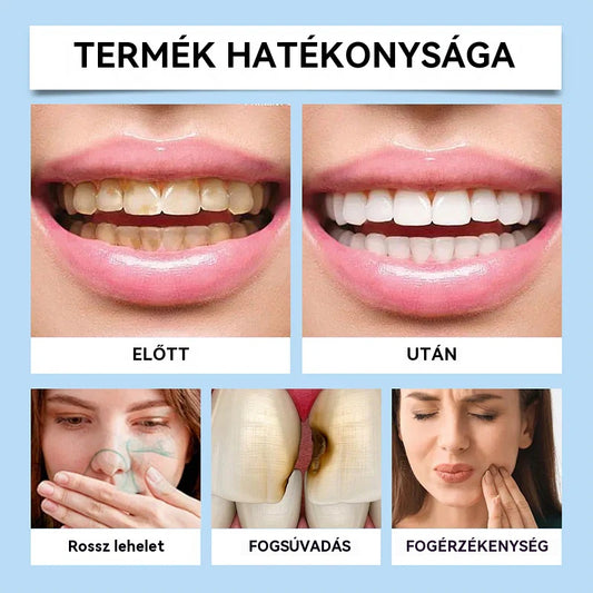 🔥1 vásárol 1 ingyen kap👍2026 Új modell😁Korlátozott ideig érvényes promóció🦷 Innovatív Szájspray: Vége a fogérzékenységnek!