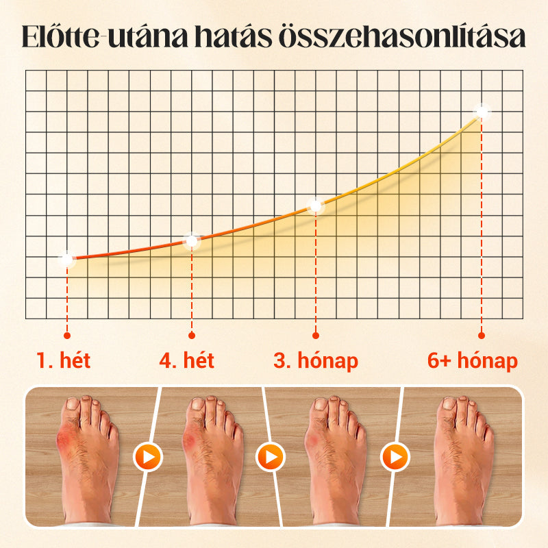 🔥🔥8 pár+2 pár ingyenes🌸💨 Láthatatlan, légáteresztő zokni🧦✨ Német minőségű bársony ötujjú zokni: 24 órás fájdalommentes lábajánlat!