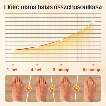 🔥🔥8 pár+2 pár ingyenes🌸💨 Láthatatlan, légáteresztő zokni🧦✨ Német minőségű bársony ötujjú zokni: 24 órás fájdalommentes lábajánlat!