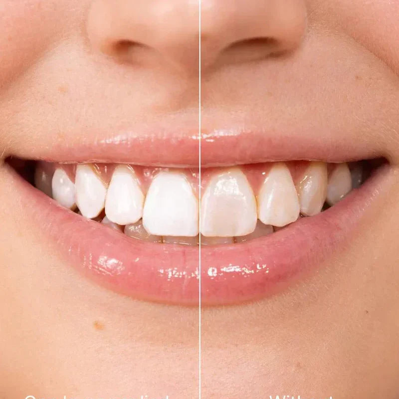 🔥1 vásárol 1 ingyen kap🦷5 Másodpercben Fehérebb Mosoly! Instant Whitening Tooth Paint – Biztonságos + Tartós!