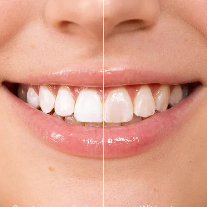 🔥1 vásárol 1 ingyen kap🦷5 Másodpercben Fehérebb Mosoly! Instant Whitening Tooth Paint – Biztonságos + Tartós!