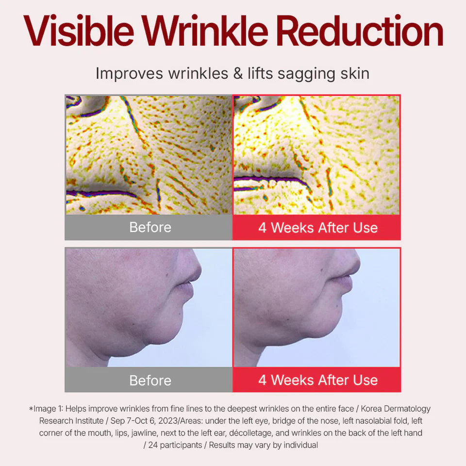 🔥1 vásárol 1 ingyen kap⏳Time Reverse Anti-Aging Cream – Azonnali lifting + ránctalanítás 50 ml-ben!