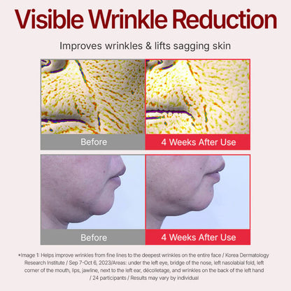 🔥1 vásárol 1 ingyen kap⏳Time Reverse Anti-Aging Cream – Azonnali lifting + ránctalanítás 50 ml-ben!