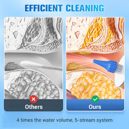 🎁Ingyenes ajándék 24 db fülpálcika😜40% árcsökkentés👂 Fülviasz eltávolító készlet💧 Vízes sugárzásos fültisztító – Irritáció és sérülés nélkül, minden korosztálynak!