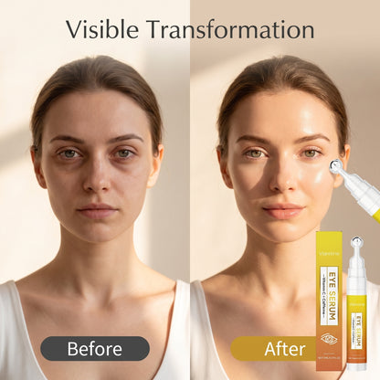 🔥2+2 INGYEN (4 db)👀✨ C-vitamin + koffein görgős szemápoló – 🔄 Jéghideg fémgörgővel a duzzanat és a sötét karikák ellen! 💖