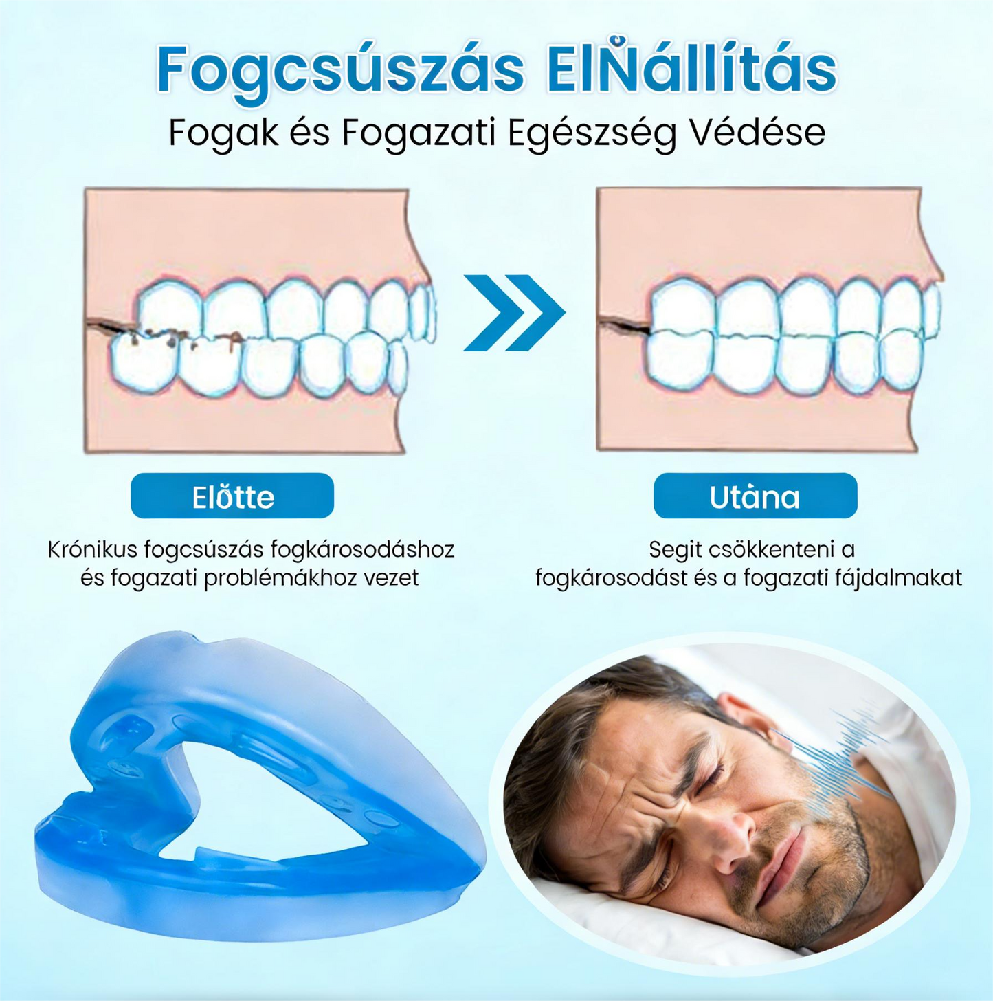 🎁Vásárolj 1 kapsz 1 ingyen😴Horkolásgátló szájbetét – Csökkentse a horkolást már az első éjszakától! 🛏️CPAP/MAD Alternatíva – 180 Napos Garancia!