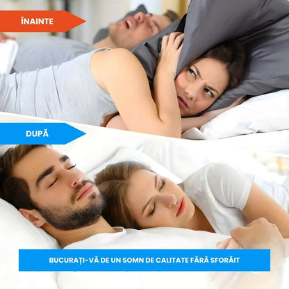 [🎁🎁3+2 ingyenes]😴 SforaFix – Azonnali horkolásgátló akupresszúrával!😍