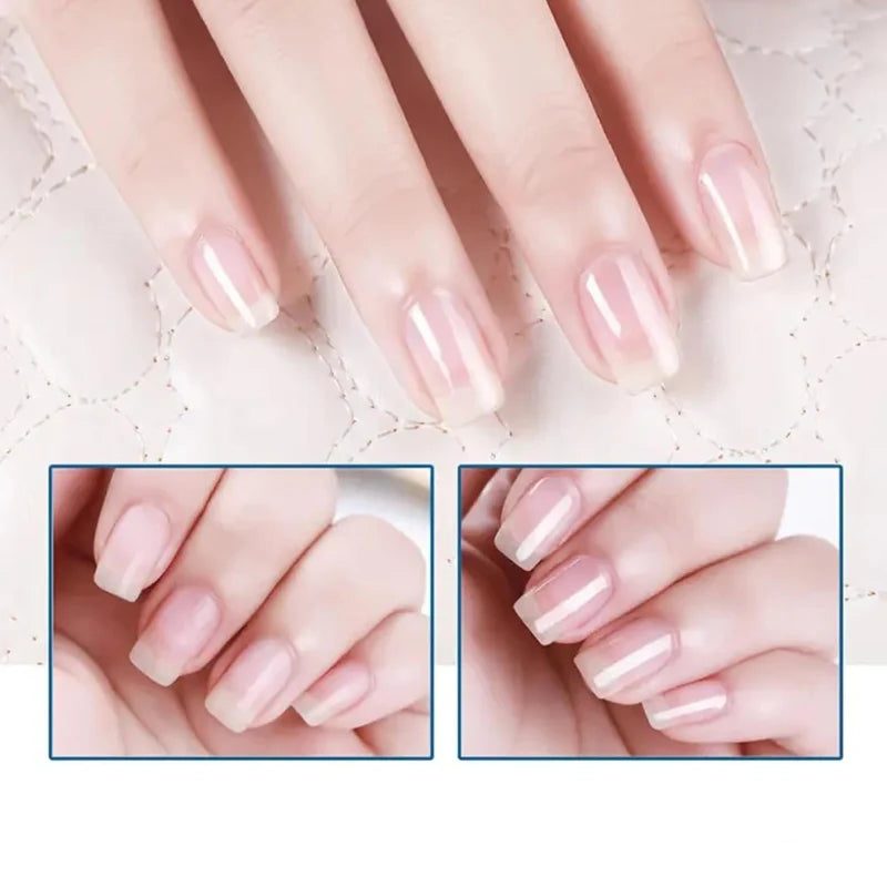 🎁1 vásárol 1 ingyen kap 💅 Természetes körömregeneráló✨ Körömápoló olaj – Fényes, erős és egészséges körmök pillanatok alatt！