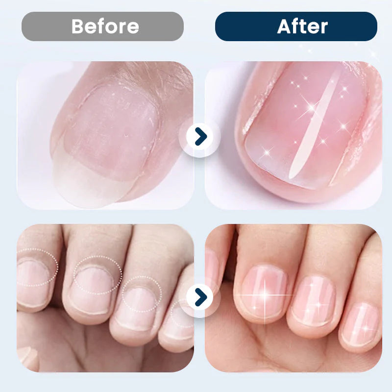 🔥1+1 ingyenes💅 Körömápolás spray✨ Gyorsan száradó, tápláló formula – Könnyű és hatékony ápolás!